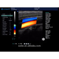 Máquina acessível portátil do ultra-som do eco de Doppler da cor 2D para a venda